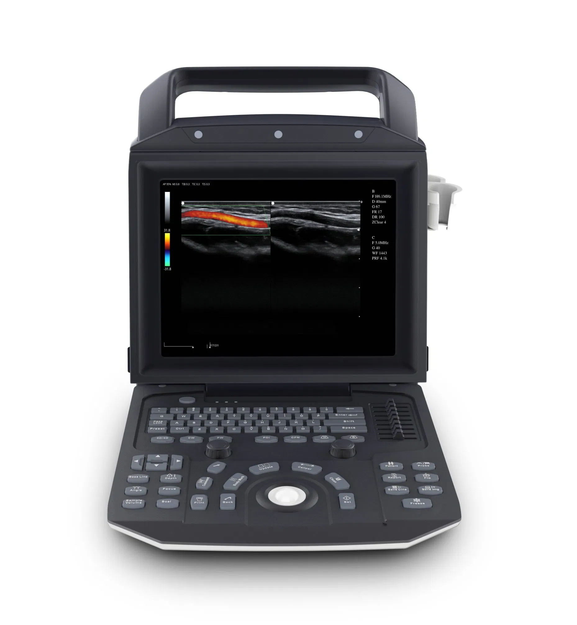 Customizable Animal Pregnancy Scanner with 12 Inch HD LED Monitor and Touch Screen