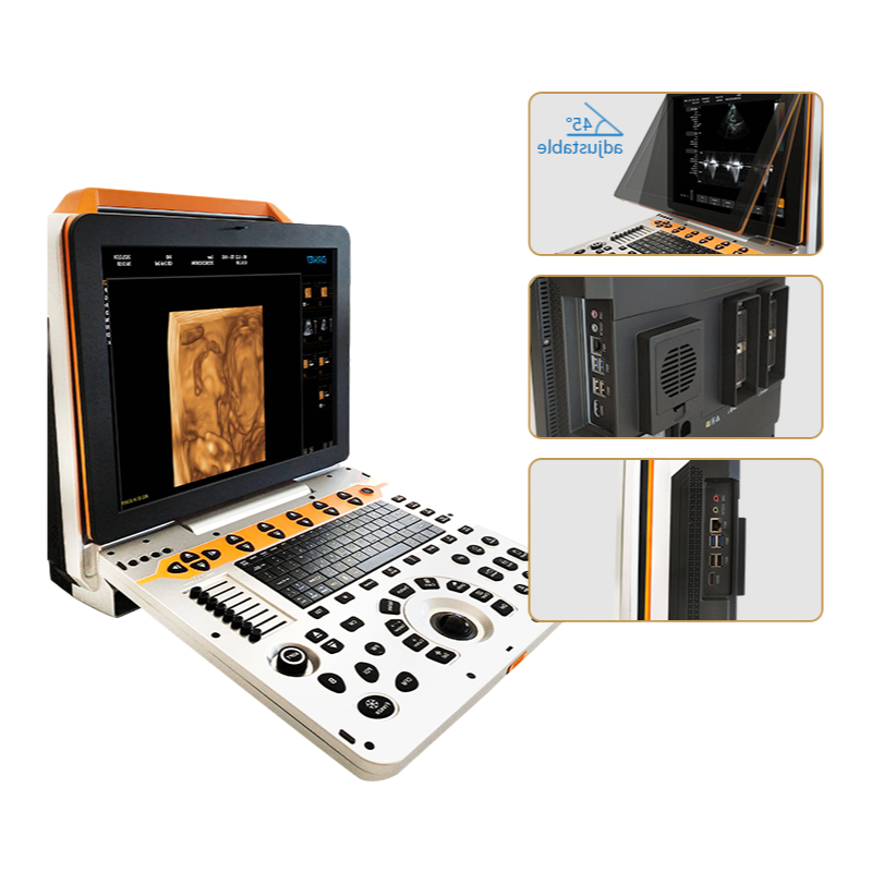 Advanced DW-P60 Ultrasound Machine with Broadband Frequency Conversion Probes