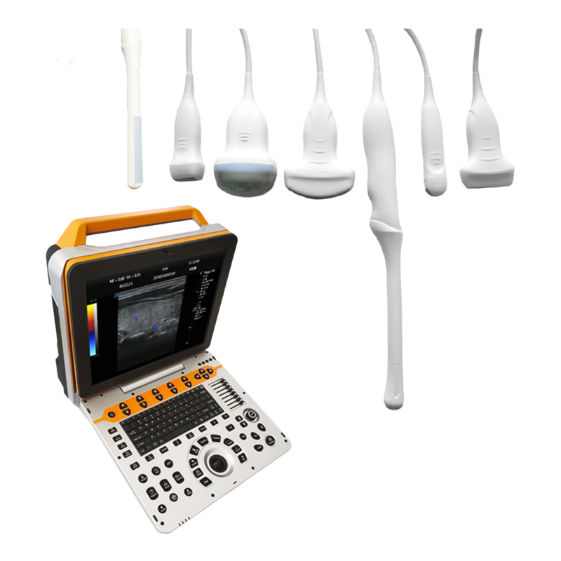 Advanced DW-P60 Ultrasound Machine with Broadband Frequency Conversion Probes