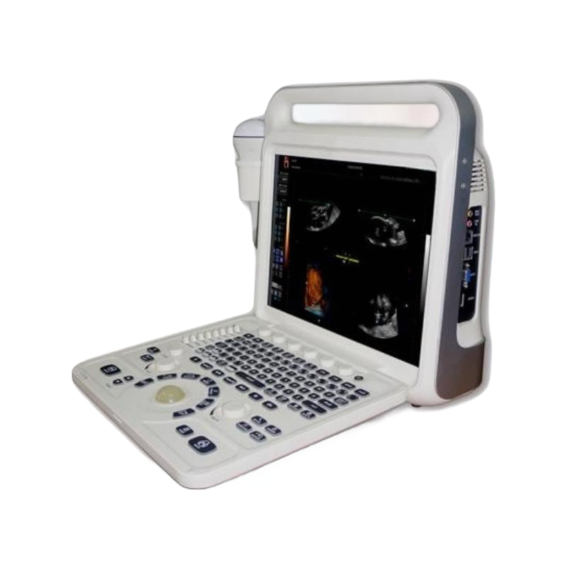 Custom OEM THR-US3600 Ultrasound Diagnostic Equipment with CE ISO13485 Certification