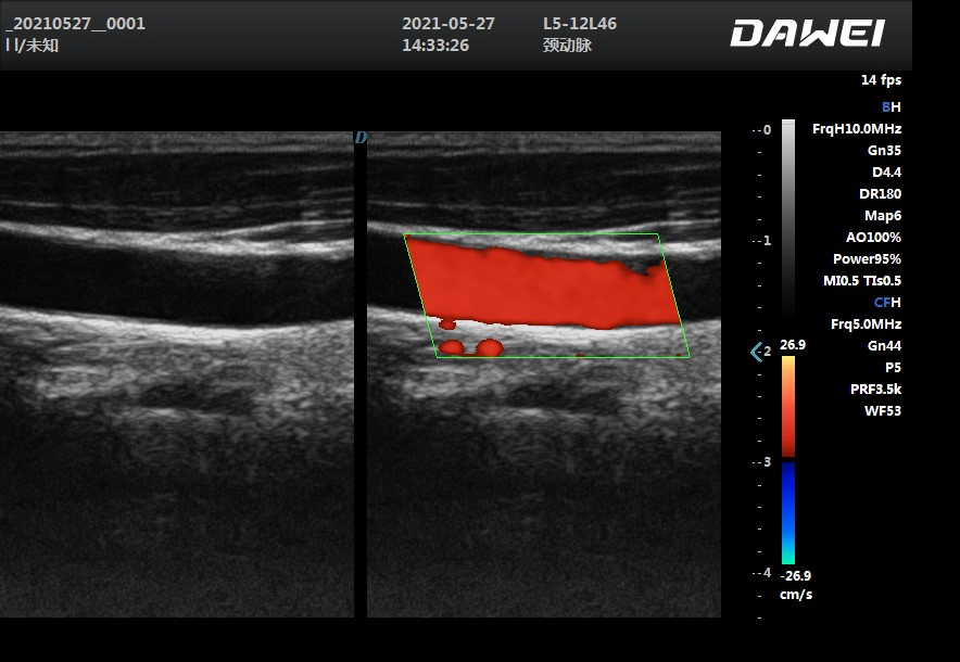DW-L50 Multi-Frequency Ultrasound Scanner with Windows 10 OS for Abdomen and OB/GYN Diagnosis
