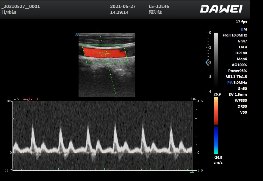 DW-L50 Multi-Frequency Ultrasound Scanner with Windows 10 OS for Abdomen and OB/GYN Diagnosis