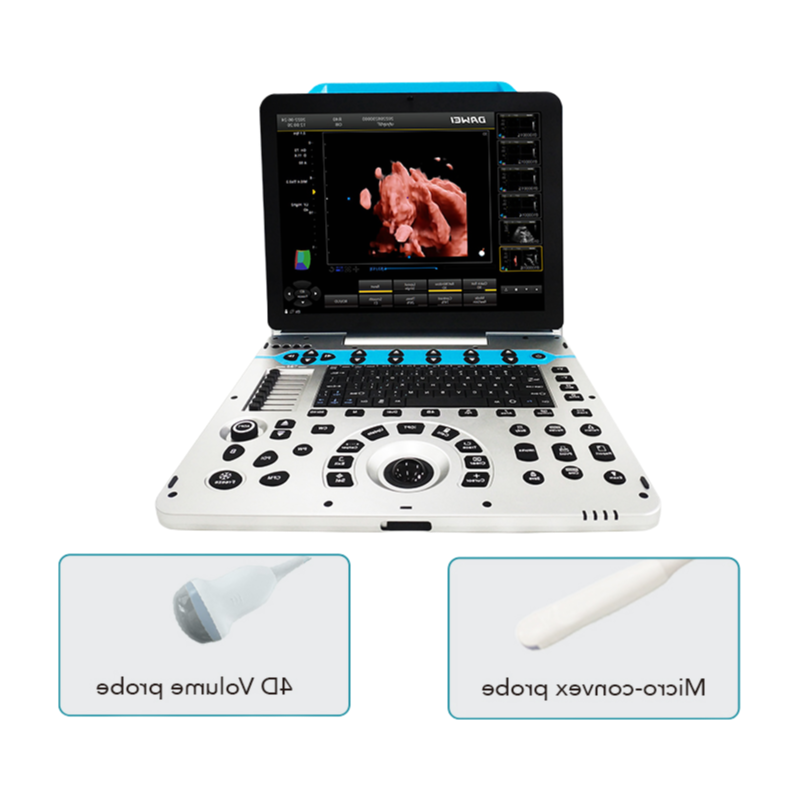 Professional Color Ultrasonic Diagnostic Apparatus with 15 Inch Adjustable Monitor and Multi-Language Support
