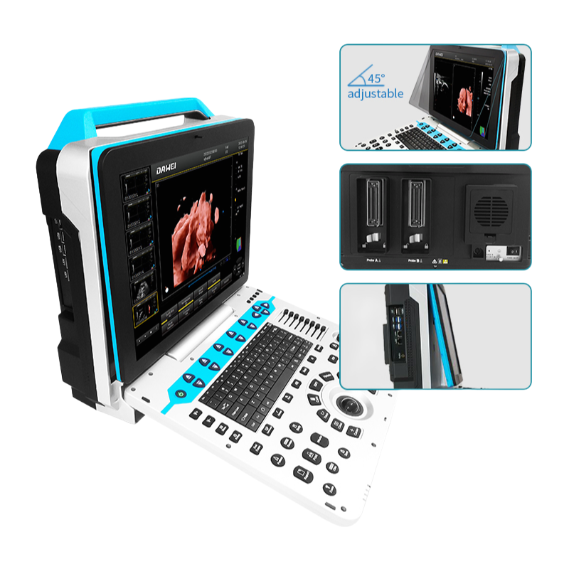 Professional Color Ultrasonic Diagnostic Apparatus with 15 Inch Adjustable Monitor and Multi-Language Support