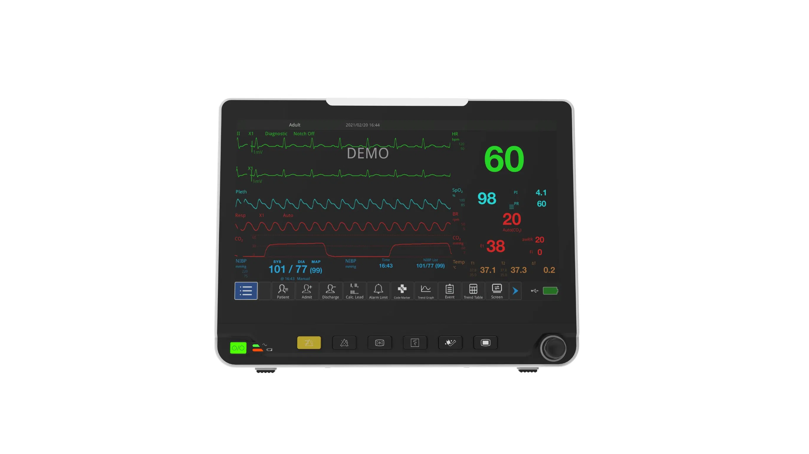 15-Inch Multi-Parameter Patient Monitor with CO2 Monitoring - HD 12 Model