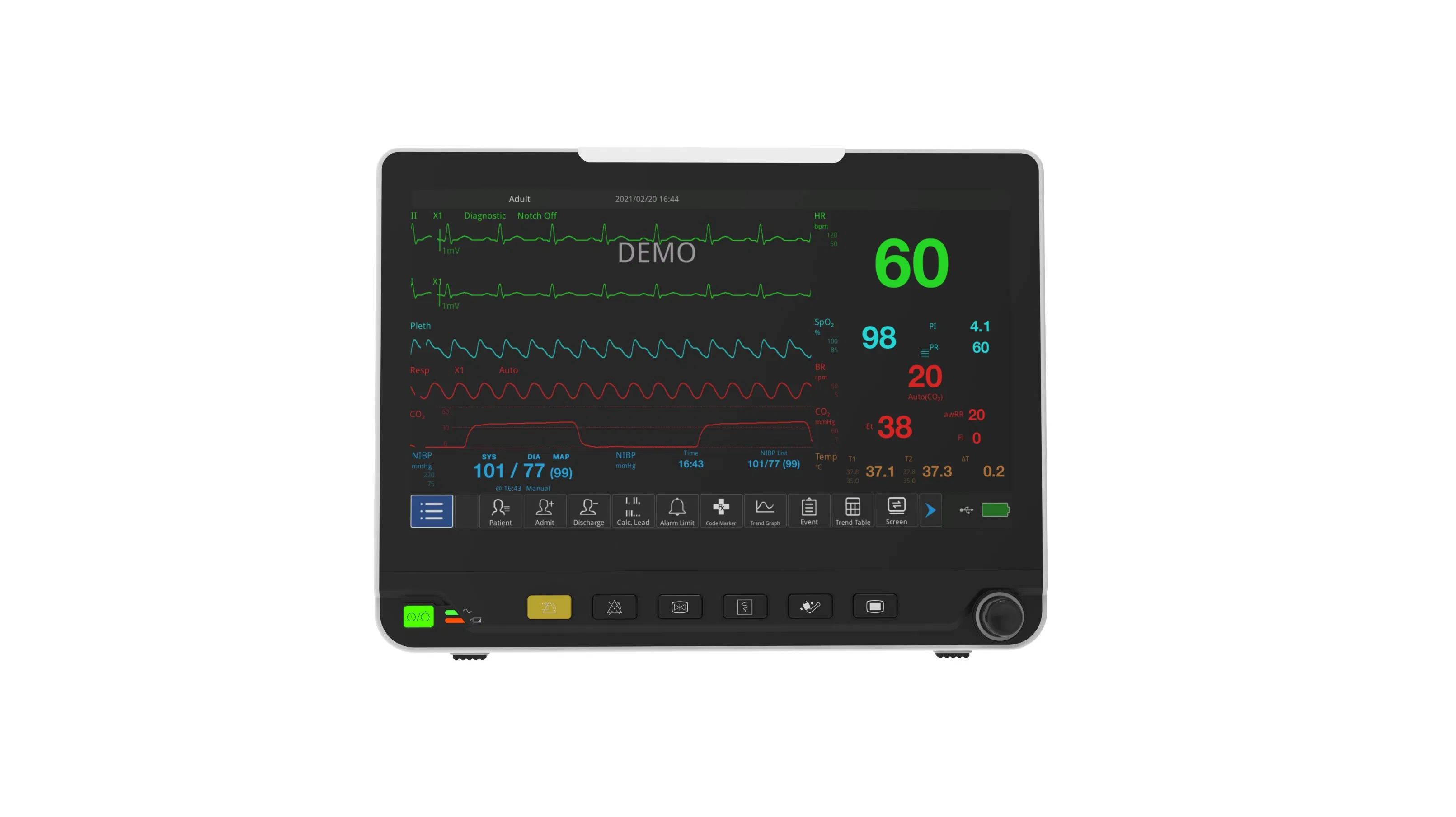 15-Inch Multi-Parameter Patient Monitor with CO2 Monitoring - HD 12 Model