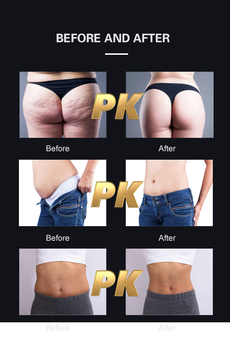 High-Intensity Pulse Electromagnetic Wave Fat Burning and Muscle Building Equipment
