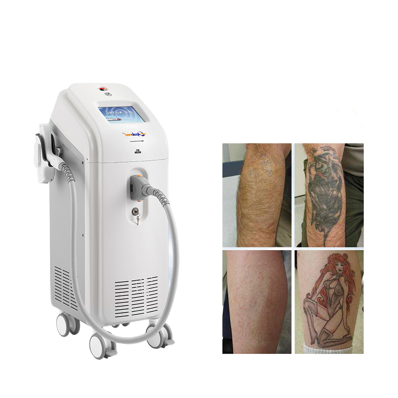 Apolo Brand Q-Switch ND YAG Laser Machine for Pigmentation and Tattoo Removal Treatments