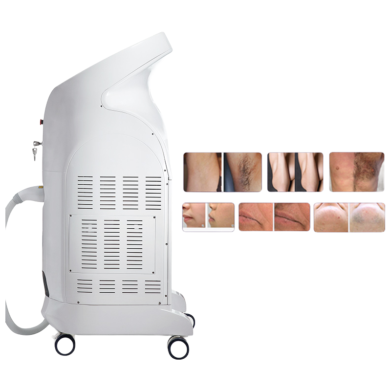 High Power 500W Diode Laser Hair Removal Machine No Pain No Burn Permanent Results