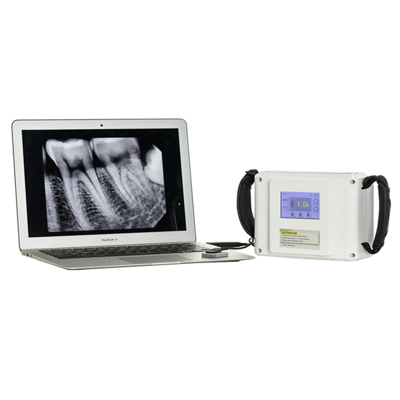 Portable Dental X-Ray Machine with Digital Imaging for Oral Diagnosis - 60KV High Frequency Inverter Technology