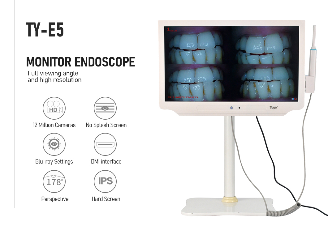 Professional Dental Intraoral Camera System with 21.5 Inch HD Monitor - 15MP CMOS Sensor for Precise Oral Examination