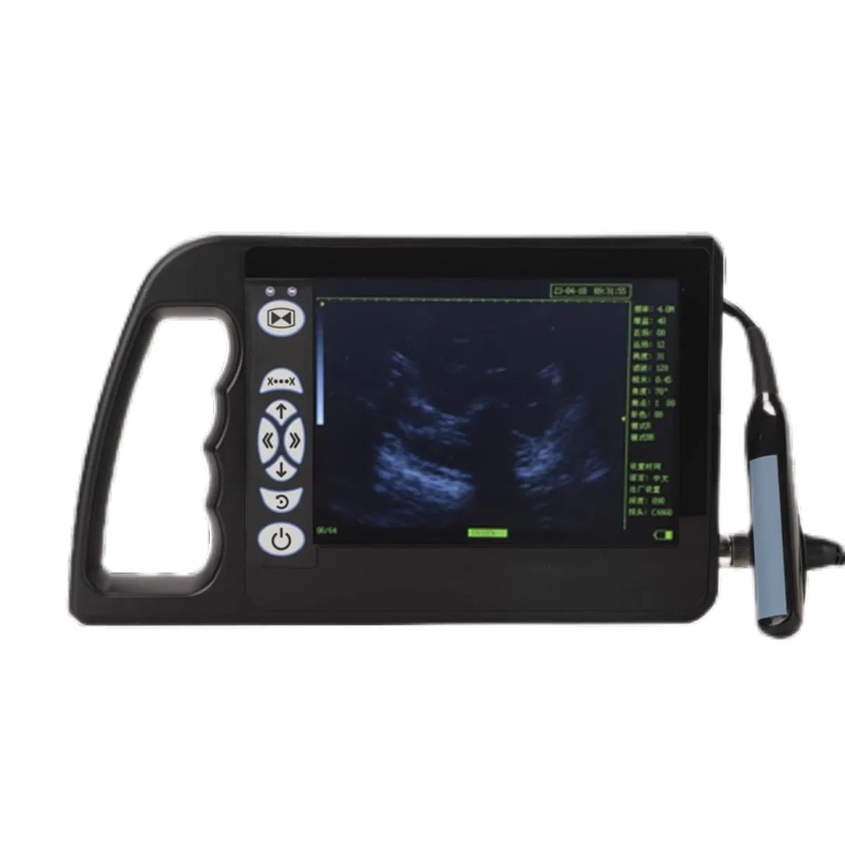 Portable Digital Veterinary Ultrasound Scanner for Sheep Cattle Pig Dog Pregnancy Detection