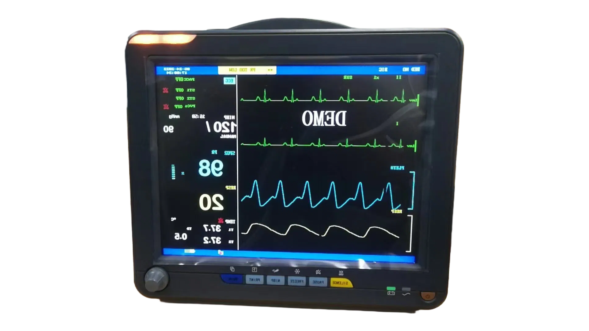 High-Precision Vet Monitor with ECG NIBP SpO2 Temperature for Dog Cat Hospital Use
