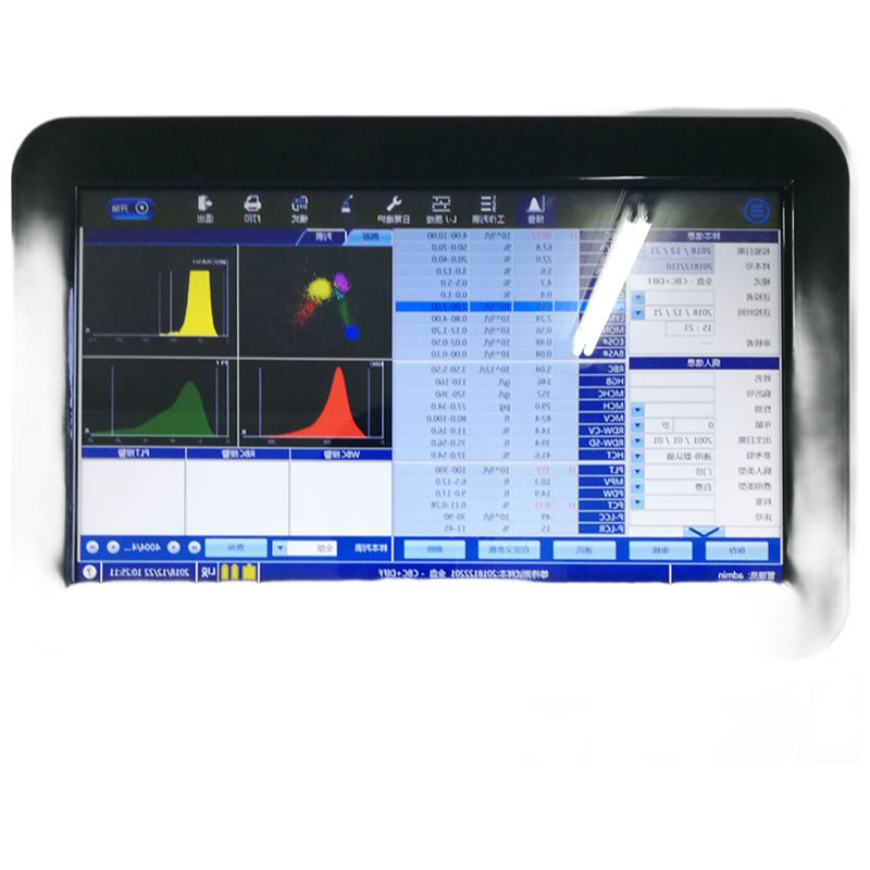 BK-6310 5 Part Auto Hematology Analyzer with 60T/H Throughput for Clinical Laboratories