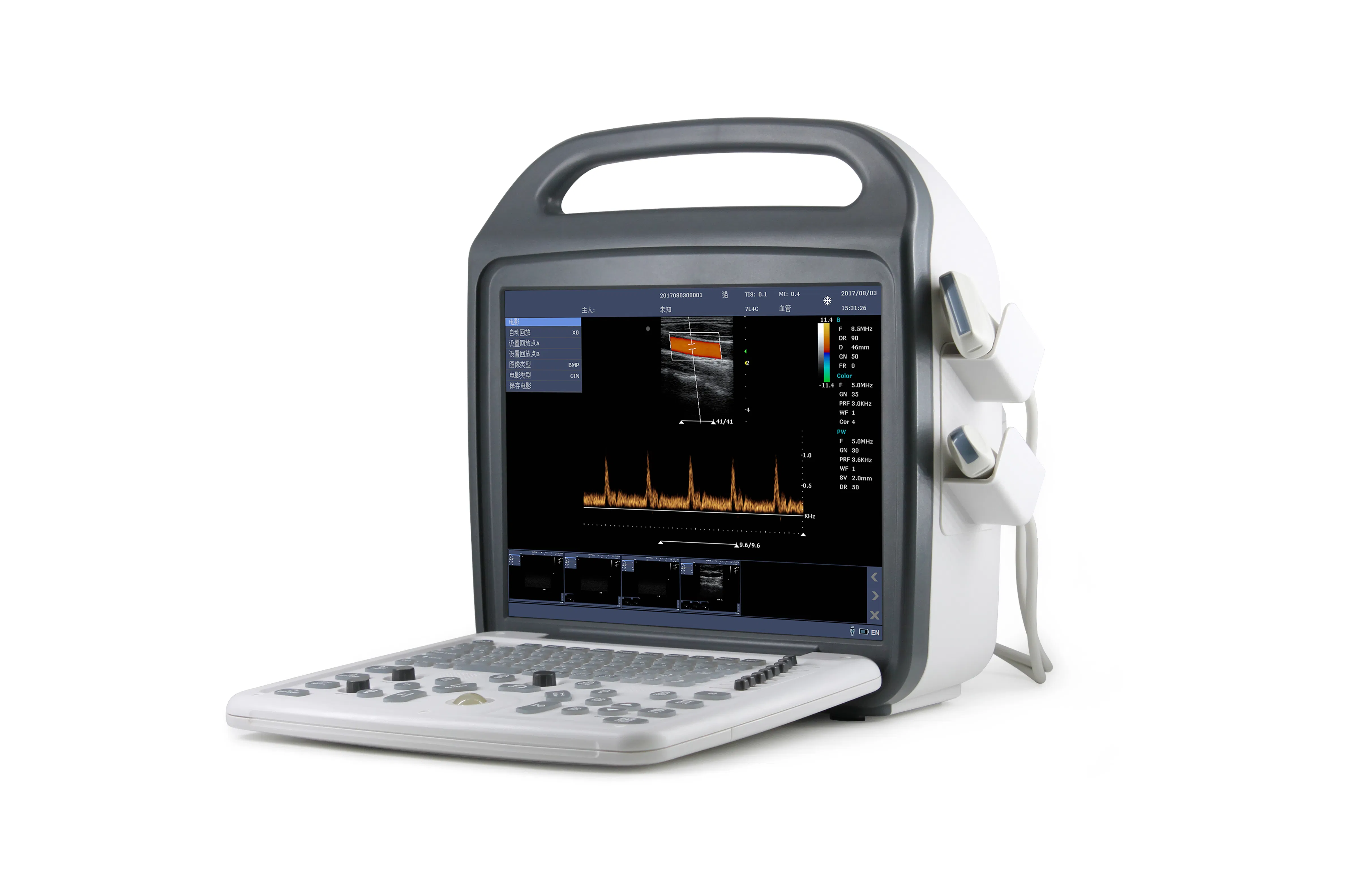 Custom DCU10 Animal Ultrasound Machine with B/M/Color/PDI/PW Modes for Comprehensive Exams