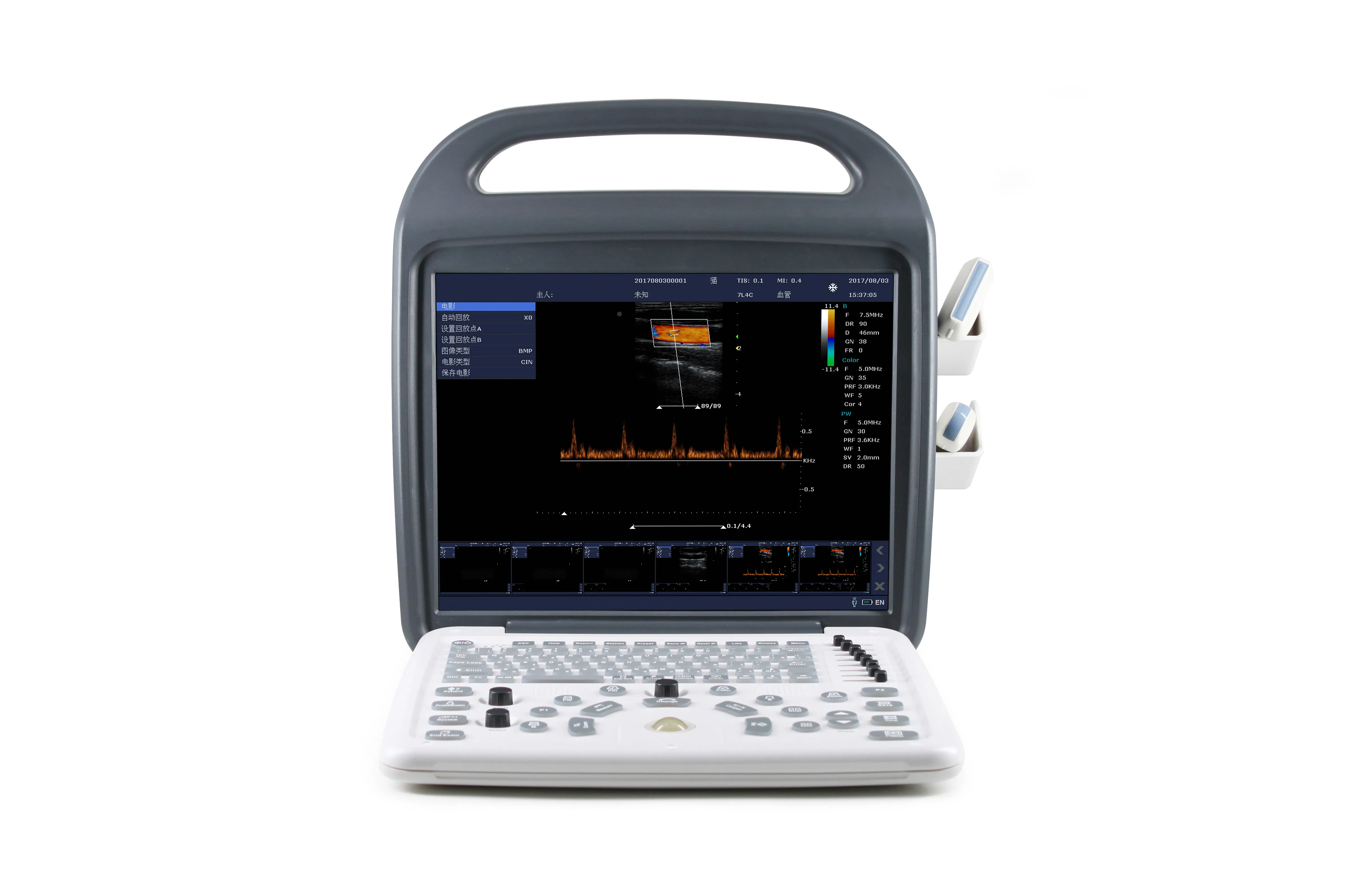 Custom DCU10 Animal Ultrasound Machine with B/M/Color/PDI/PW Modes for Comprehensive Exams