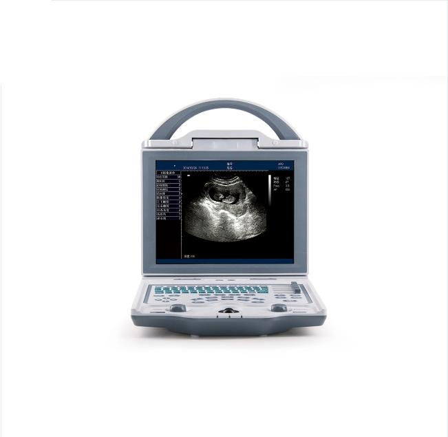 Full Digital Veterinary Ultrasound Scanner with 256 Gray Scale and 8 Steps TGC for Professional Animal Care