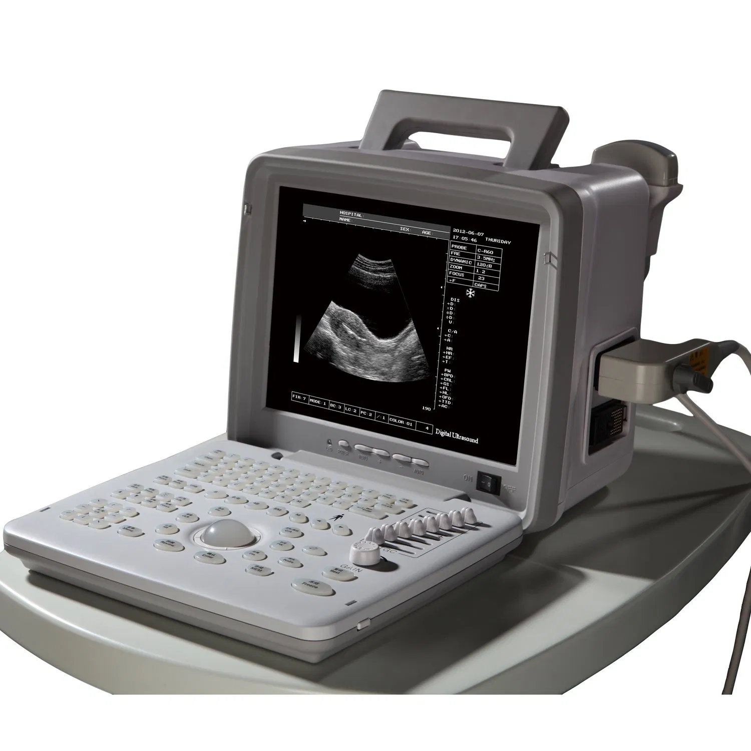 B&W Ultrasound Equipment with Intelligent Fluorescence Trackball and Dynamic Range Adjustment
