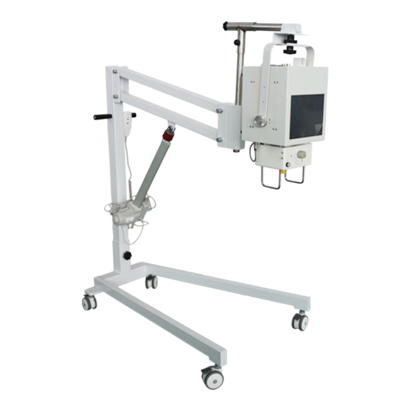 High-Quality Color Doppler Ultrasound Scanner UMY-6096 with Customized Options