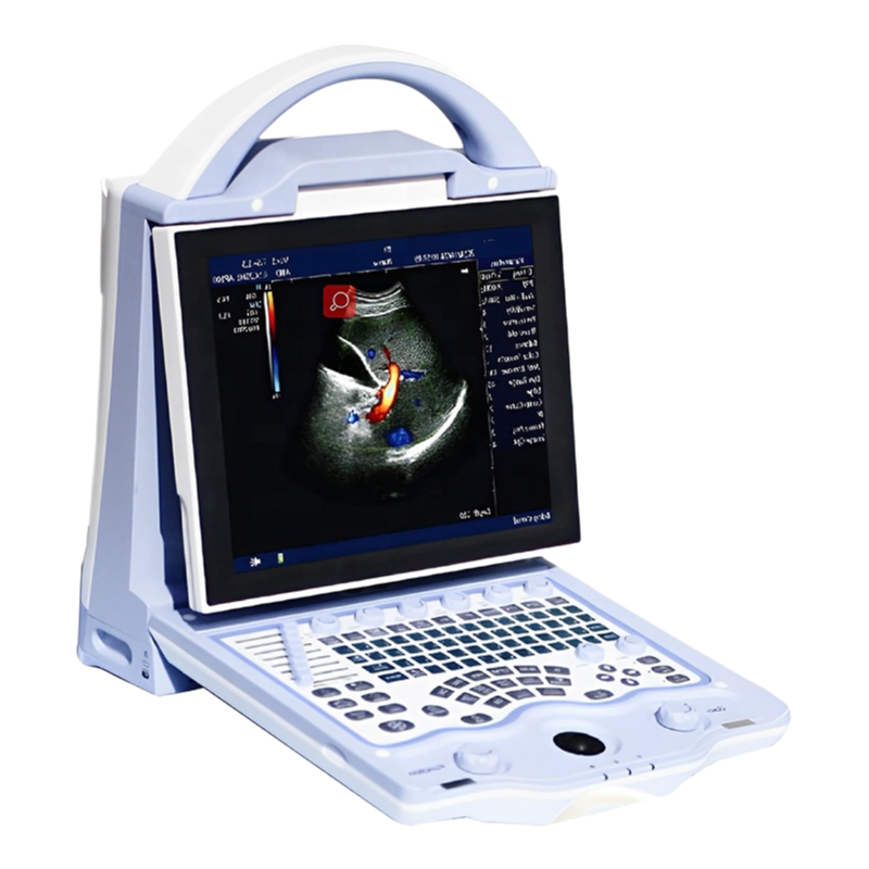 Medical Grade 3D 4D Ultrasound System with Gel Heating Cup and Touch Screen