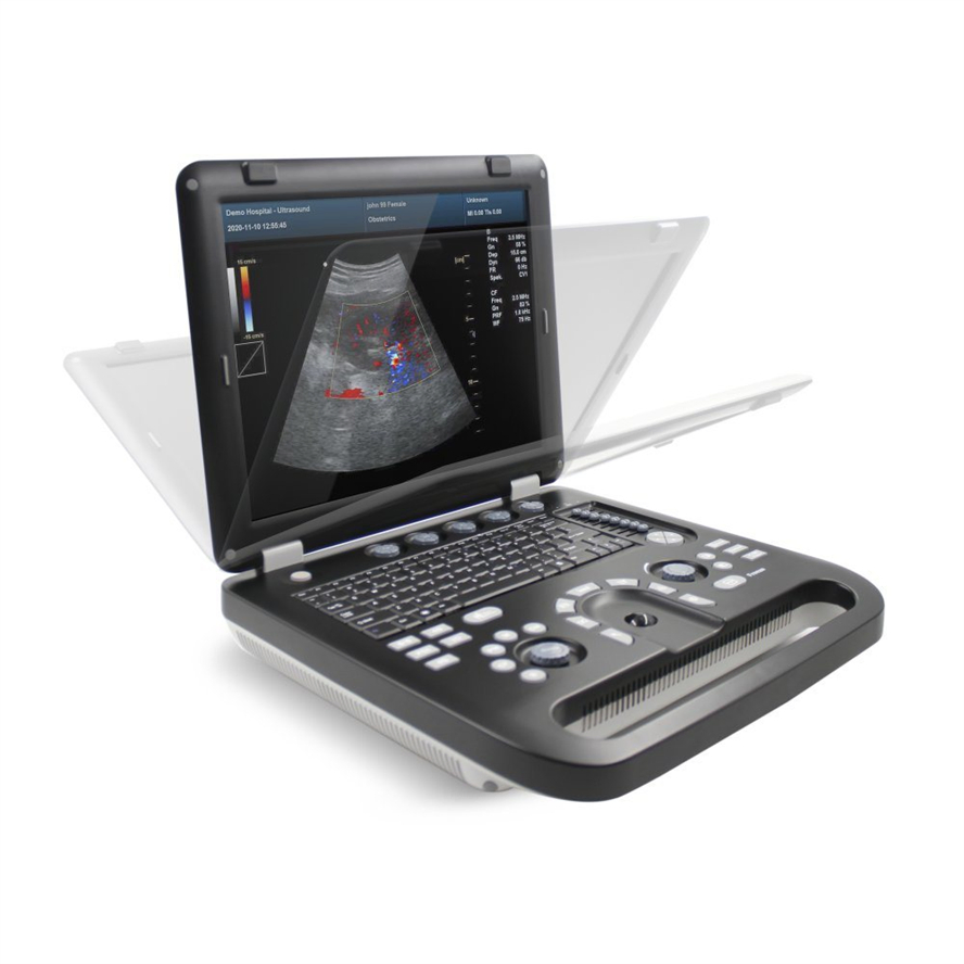 Wholesale Contec CMS1700C Diagnostic Ultrasound Equipment with CE/ISO13485 Certification