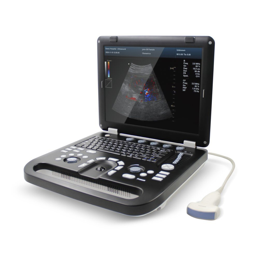Wholesale Contec CMS1700C Diagnostic Ultrasound Equipment with CE/ISO13485 Certification