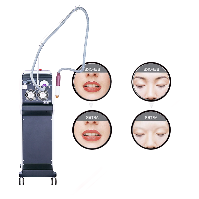 Professional Picosecond Beauty Machine for Skin Rejuvenation and Pigment Removal with 15Hz Frequency