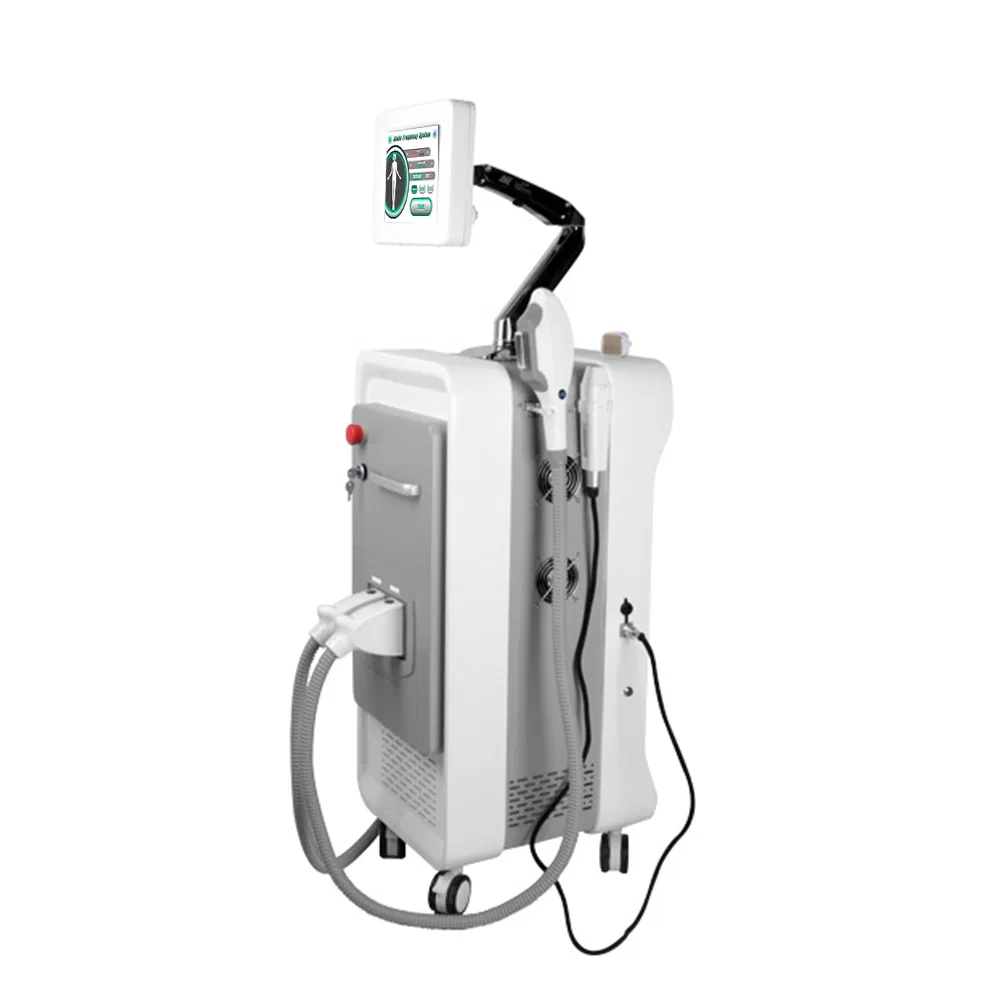 Advanced Q-Switched ND YAG Laser Pigmentation Removal Equipment for Skin Rejuvenation