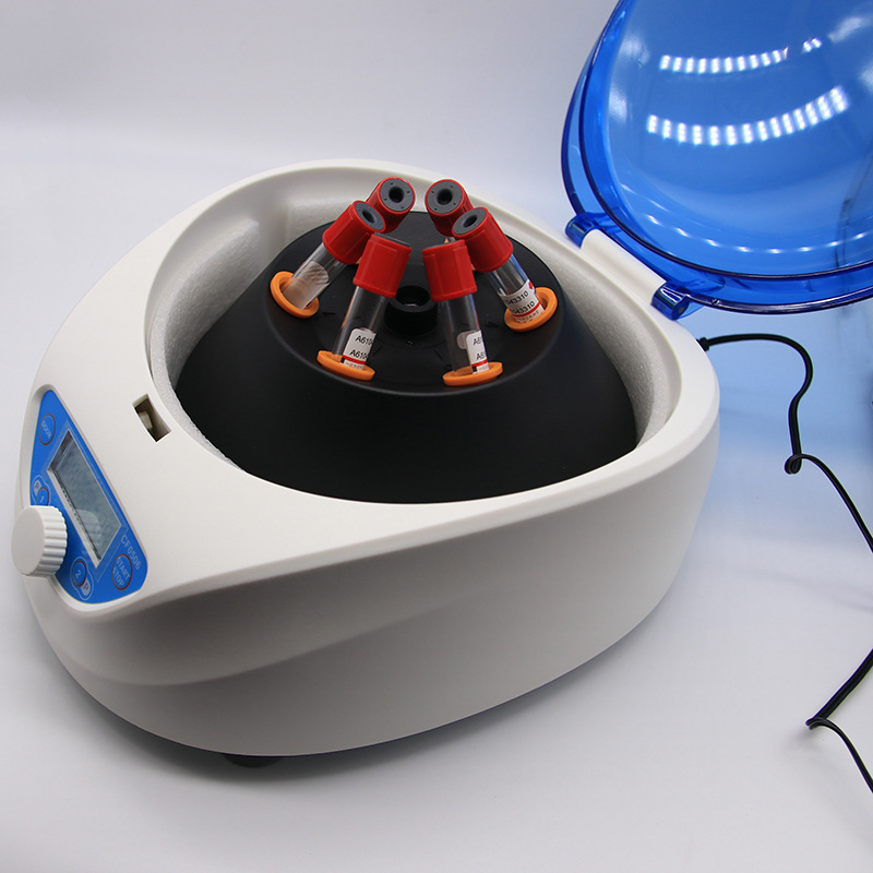 China Factory Direct 5000RPM Portable PRP Centrifuge – 1 Year Warranty, OEM Available, MOQ 1 Unit