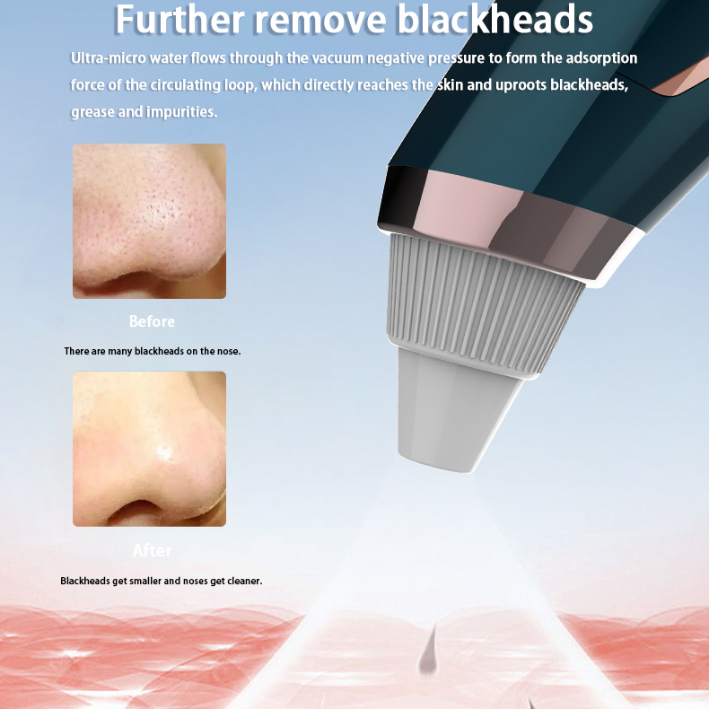 Home Beauty Equipment OEM/ODM Ultrasonic Blackhead Remover – Custom Spec, Your Brand, MOQ 100 Units, Sample Free