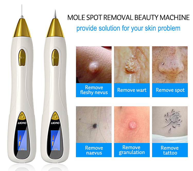 9 Level Speed China Factory Direct Mole Spot Removal Pen – 18*3.5*3.5CM, OEM ODM, MOQ 50, CE Certified